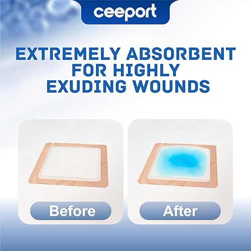 Miniatura 4 de Apósitos de silicona superabsorbentes para heridas de 5 x 5 pulgadas, vendajes adhesivos para exudado pesado, úlceras de piernas, úlceras de cama,