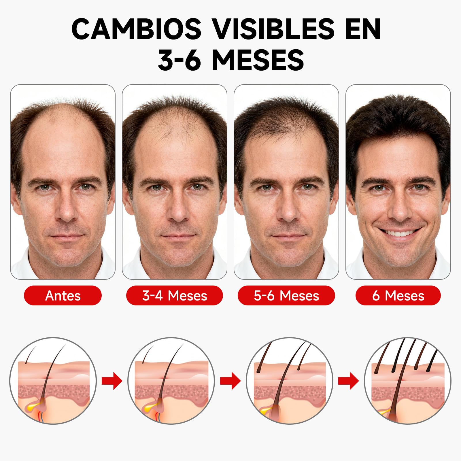 Gorra para Crecimiento del Cabello 660 nm 850 nm 7 Modos Dispositivo Láser