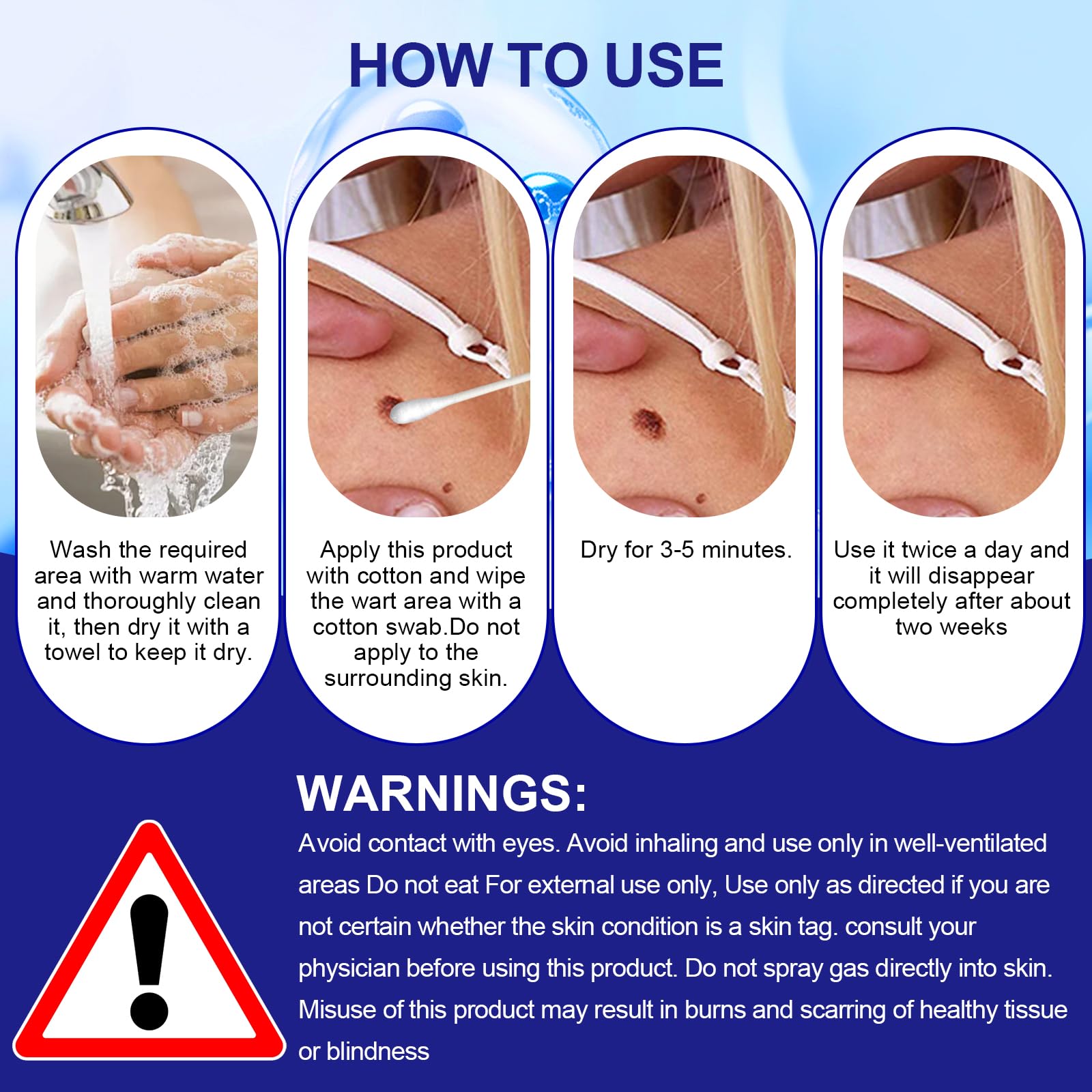 30ml Skin Tag Remover, Suavemente Las Verrugas Quitar Comunes, Mayoría de las Partes del Cuerpo, Fácil de Usar, Fórmula Suave