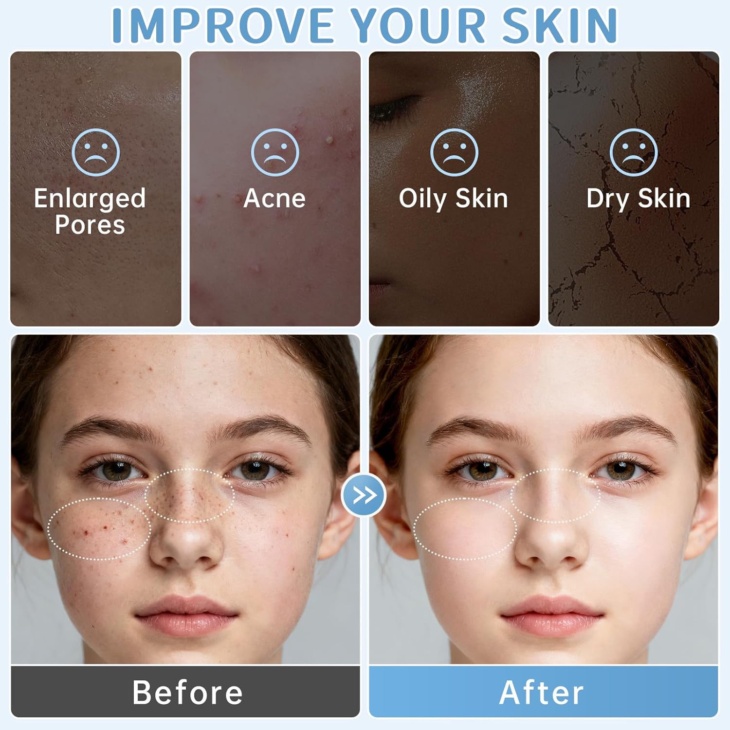 Skin Care Routine Set For Teens Age 10-12, Milk Skin Care Gift Kit For Kids Age 8-12, 11 In 1 Facial Kit With Alpha Arbutin, Hyaluronic Acid, Skin Care For Girls, Moisturizing & Gentle