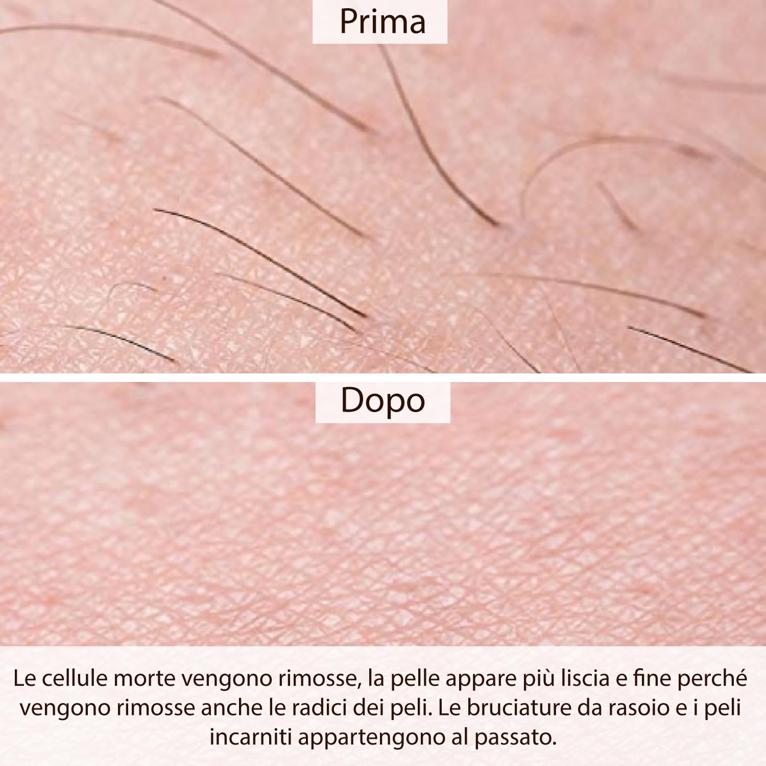 kit di prova + 100 strisce in tessuto non tessuto gratis, pasta di zucchero per la depilazione, tutte e tre le paste da 500 gr. Kit di prova, zuccheraggio per parti intime, il viso e il corpo; provalo ora