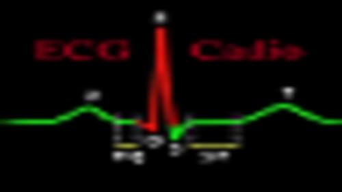 ECGCardio