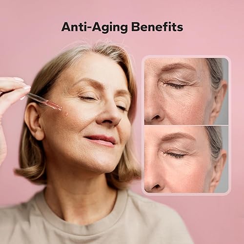 Miniatura 6 de Suero de niacinamida (1 onza líquida), 10% niacinamida + 4% ácido tranexámico, suero facial para minimizar los poros, manchas oscuras, eliminación