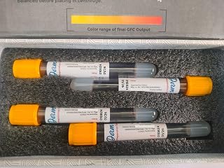 SAINI MADICOS Autologus Conditioned GFC Preparation Tube for Hair Draw Volume 6 mL (2 Box)
