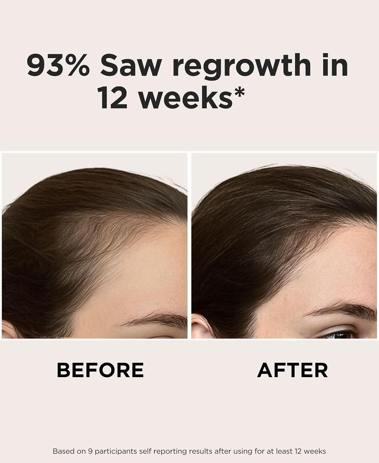 Solaris Laboratories NY Intensive LED Headband: Support Growth and Strength + 90 day Hair Journal