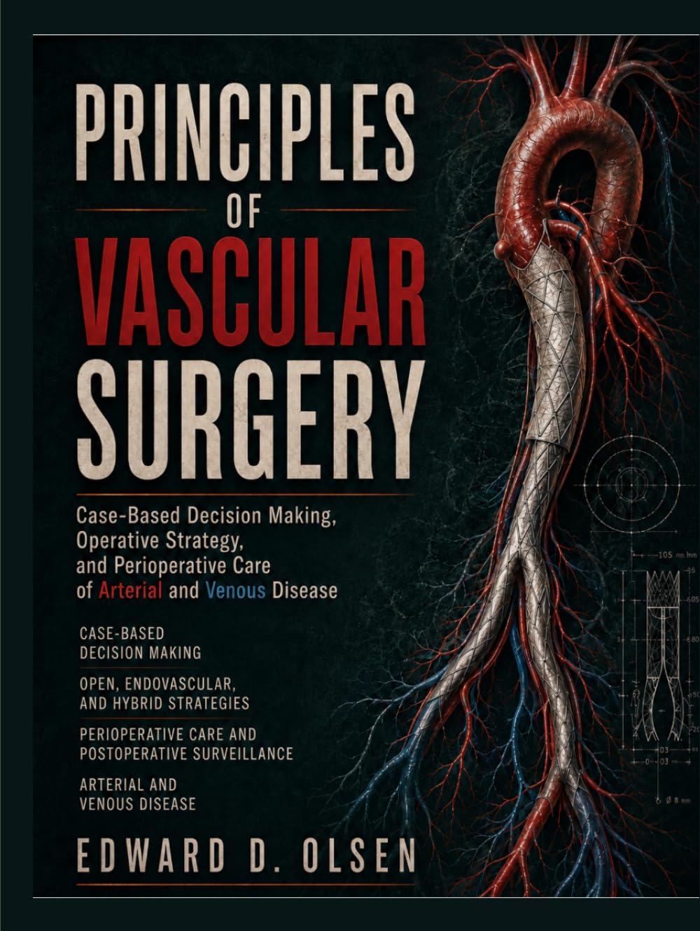 Principles Of Vascular Surgery: Case-Based Decision Making, Operative Strategy, and Perioperative Care of Arterial and Venous Disease