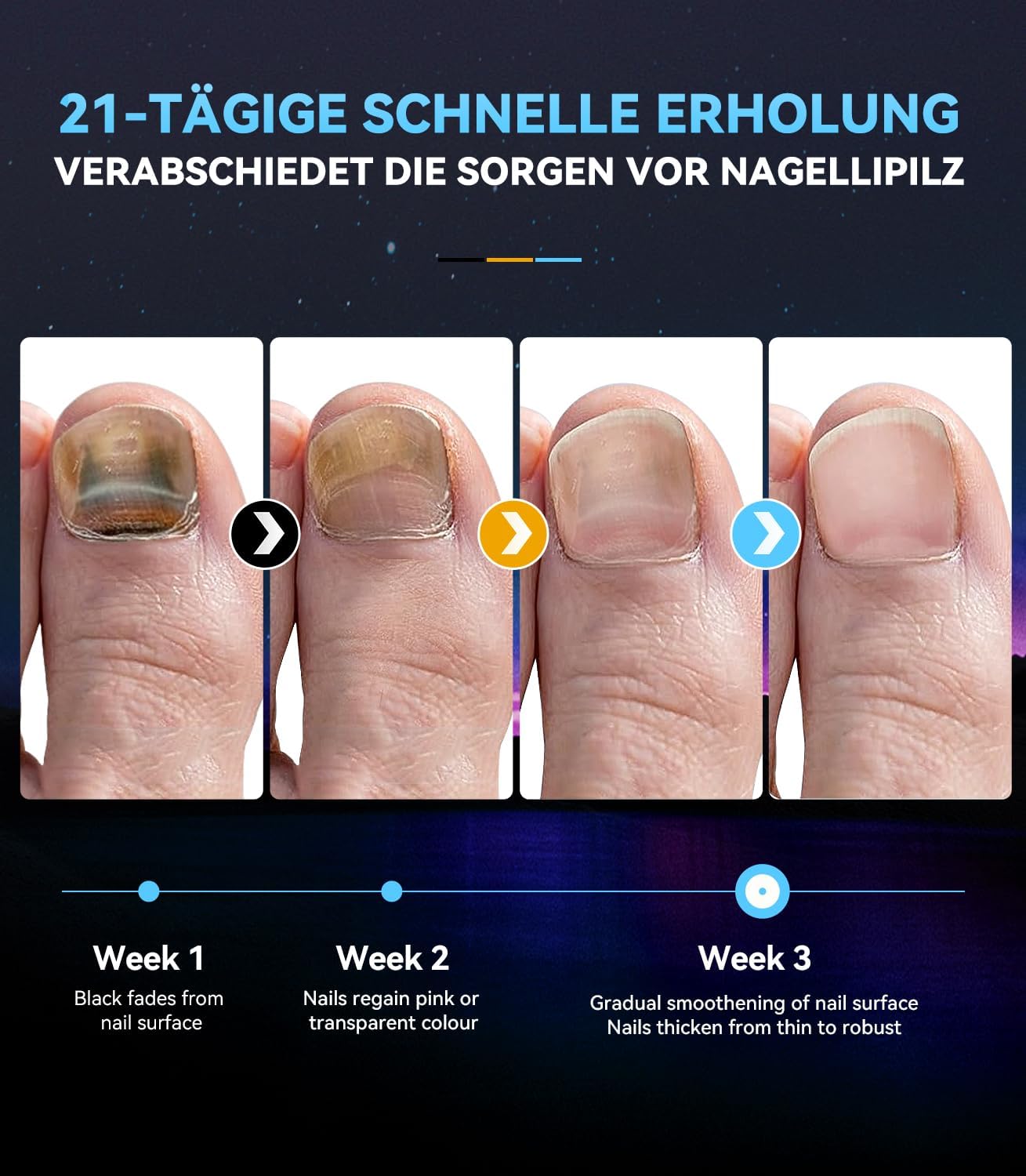Nagelpilz Lasergerät 【21-Tage schnell】【905nm Rottlicht-Technologie】Nagelpilz Testsieger mit Timer (30s/60s/99s) Für Finger & Zehen Blau