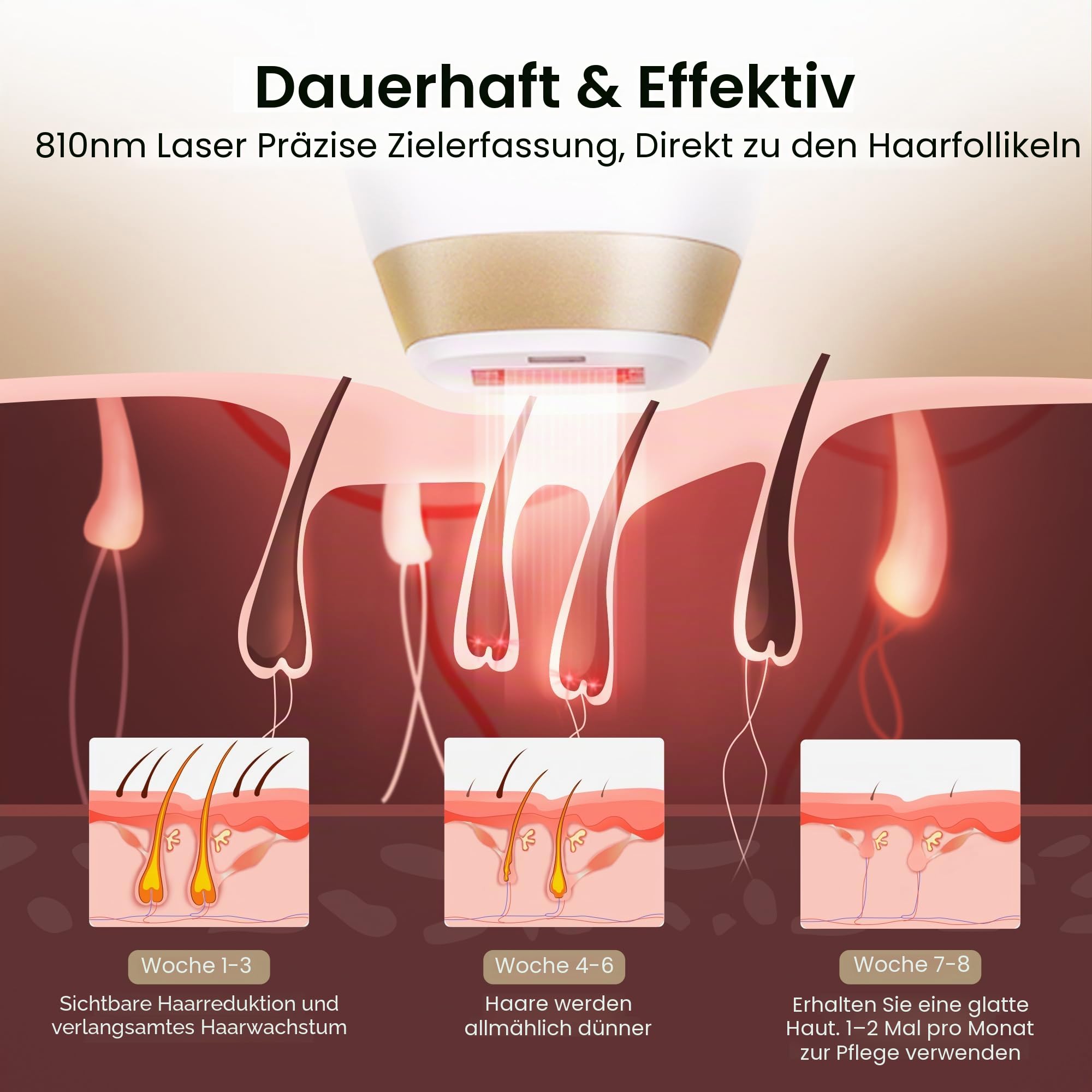 DermRays 810nm Diodenlaser Haarentfernung V4S für 1-5 Teint FDA zugelassen ICE-Cooling