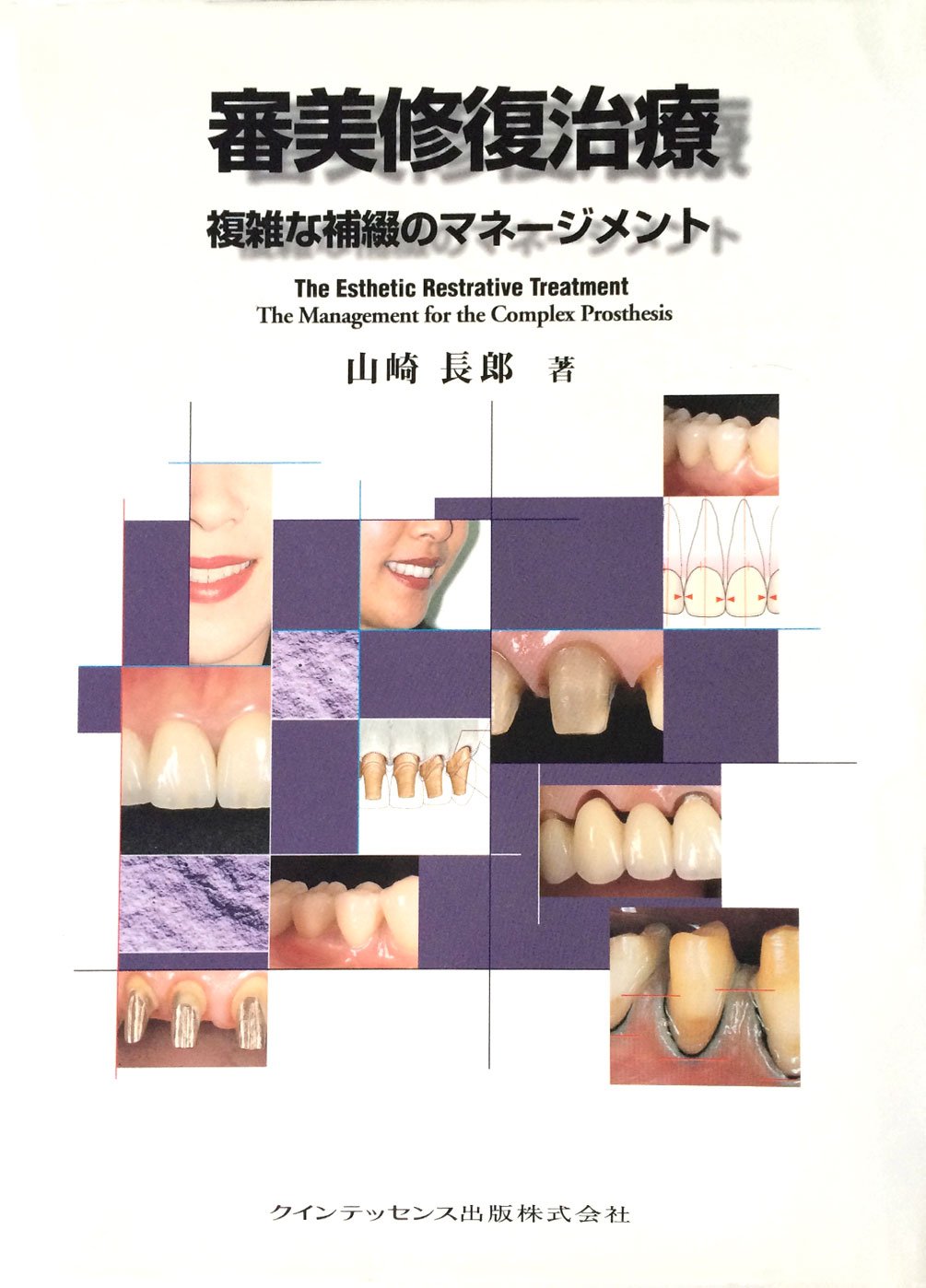 審美修復治療 複雑な補綴のマネージメント 山崎長郎著 71RLe4jFZAL.jpg