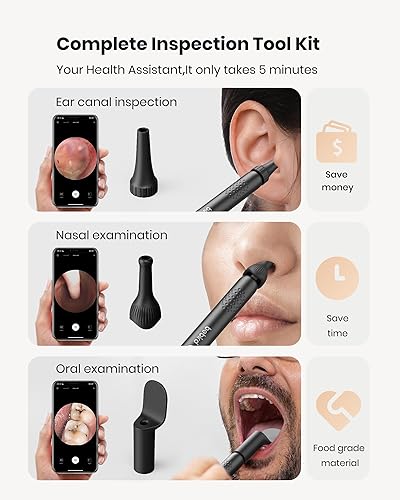 Miniatura 2 de BEBIRD R1 - Herramienta de eliminación de cera para oído, limpiador de canal auditivo con cámara 1080P, selector de orejas con puntas de repuesto