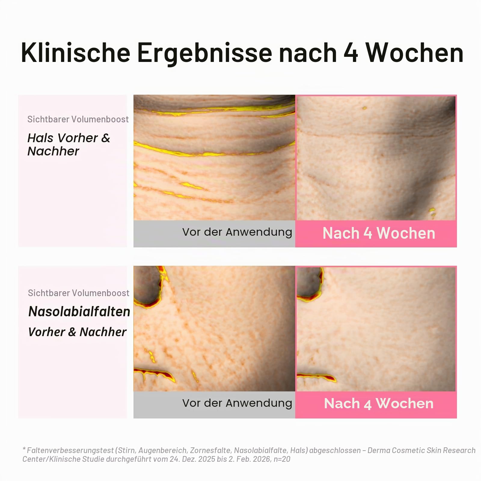 Abib PDRN Volume Fill-it Booster Cream 2,5 Tube | auffüllendes Gesichtsvolumen mit Retinalpeptiden PDRN 15.000 ppm | Für Stirn, lächelnde Linien und Nackenfalten | Straffende Anti-Aging |
