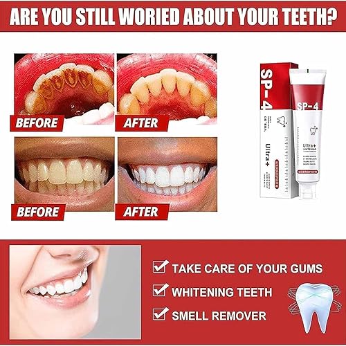 Miniatura 3 de Yayashi Sp-4 Ultra Pasta de dientes blanqueadora, pasta dental blanqueadora probiótica, blanqueamiento dental Sp4, aliento fresco (rojo1 unidad)