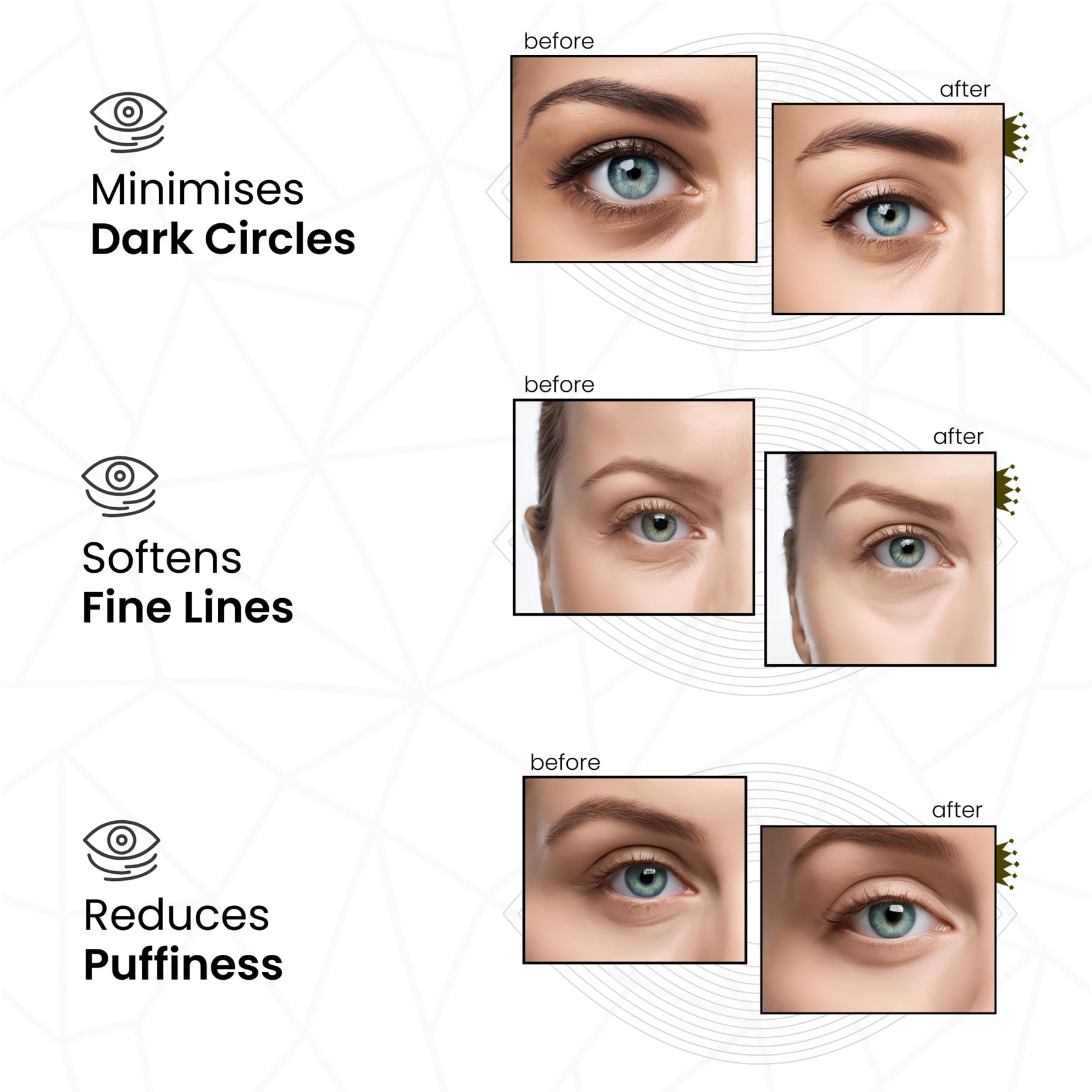 Revitale Pure Vegan Under Eye Patches, Helps Reduce Puffy Eyes & Dark Circles, Revitalise Dull Eye Masks, Nourishes, Renews - Image 3