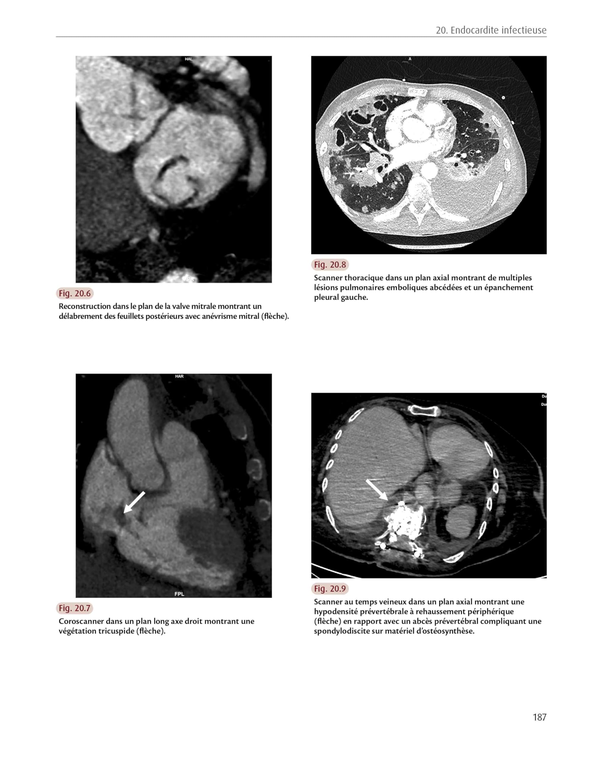 Radiologie cardiaque