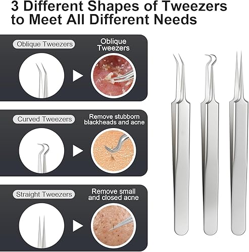 Miniatura 3 de Juego de herramientas de extracción y extracción de espinillas y acné de aleación de titanio, elimina rápida y de forma segura el acné, puntos