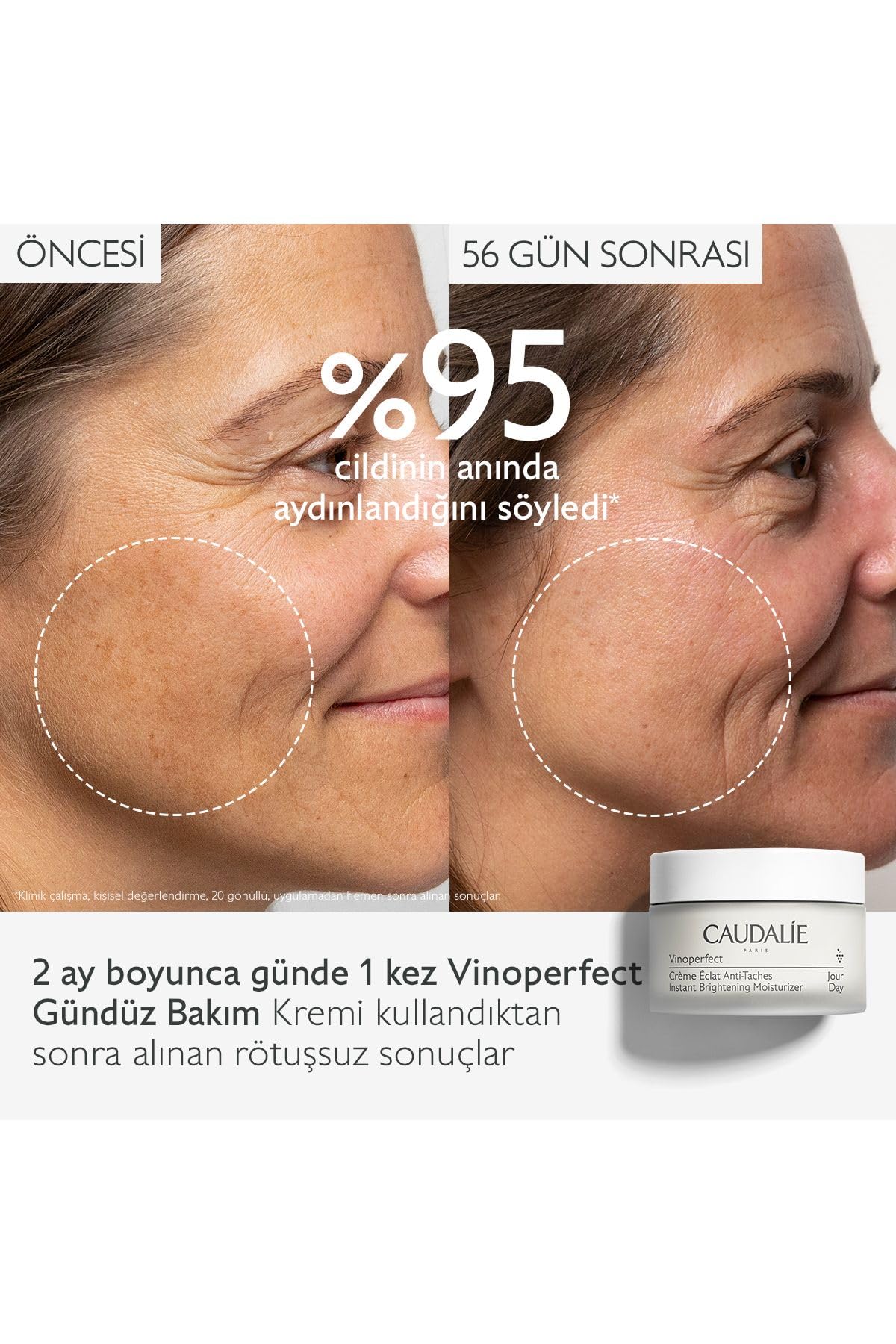 Caudalie Caudalie Vinoperfect Dark Spot Leke Karşıtı Gündüz Bakım Kremi 50ml 1 Paket (1 x 1 Adet)
