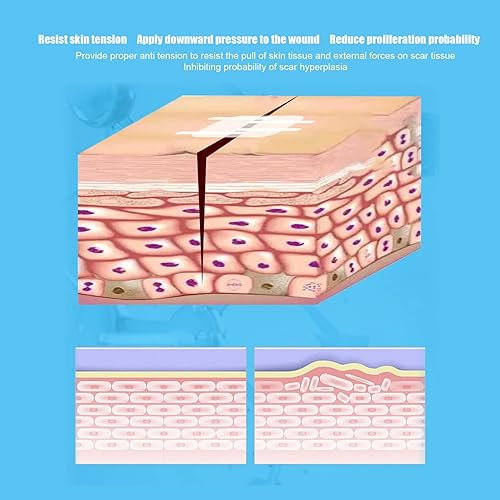 Miniatura 5 de 2 piezas de suturas de puntada con cremallera, vendas adhesivas de emergencia, kit de laceración para el cuidado de heridas