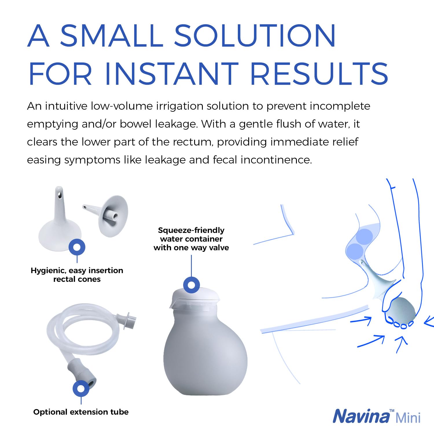 Navina Mini Start Set - Low-Volume Enema, Irrigation System for Instant Relief – Comfortable, Discreet, and Reusable - Includes 185ml Water Bulb, Extension Tube, and 5 Rectal Cones