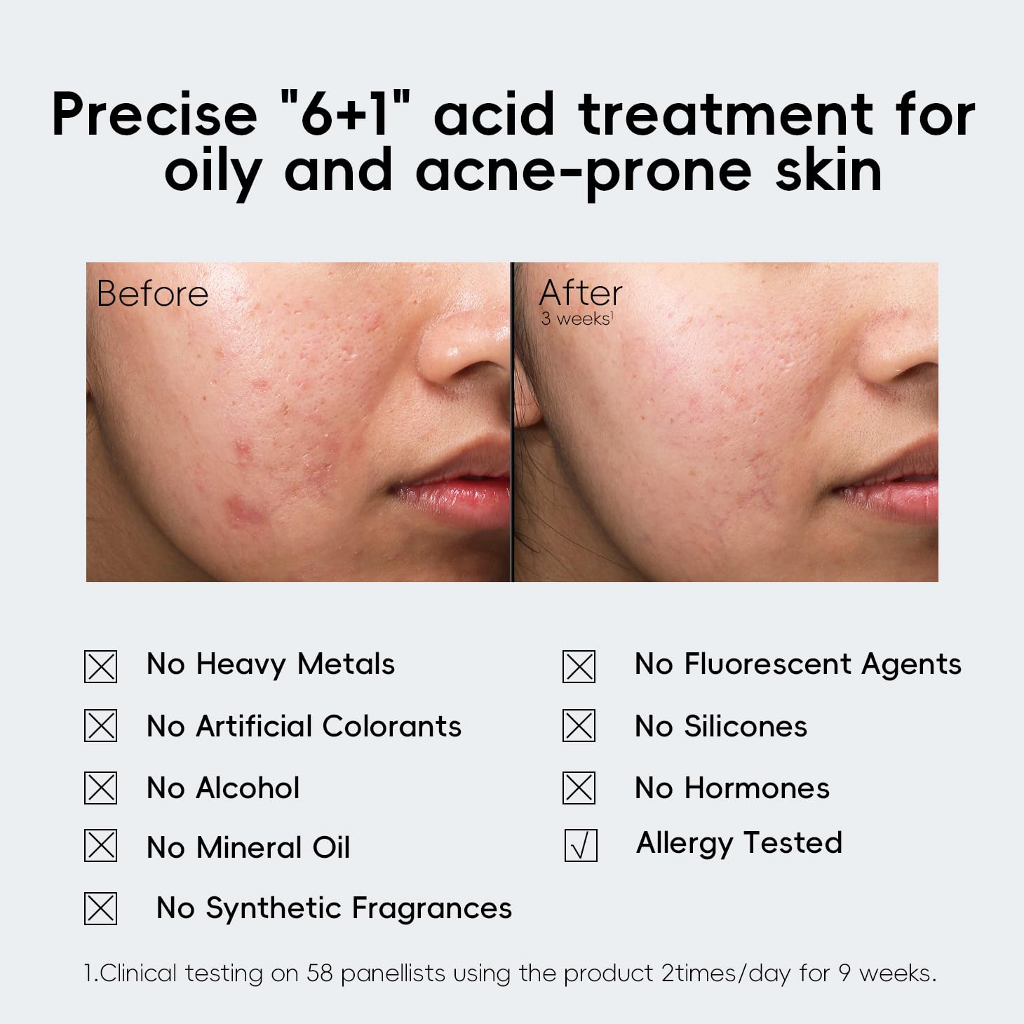 face exfoliant peel serum -3% lactic acid serum,1% azelaic acid,0.5% salicylic acid,Valentine's Day Gift,multi-acne/oily skin care,skin peel,smooth - Image 2