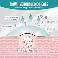 Vista 7 de Rollo hidrocoloide para el cuidado de heridas, vendajes de parche hidrocoloide con vendajes autoadhesivos, para úlceras de cama, altamente