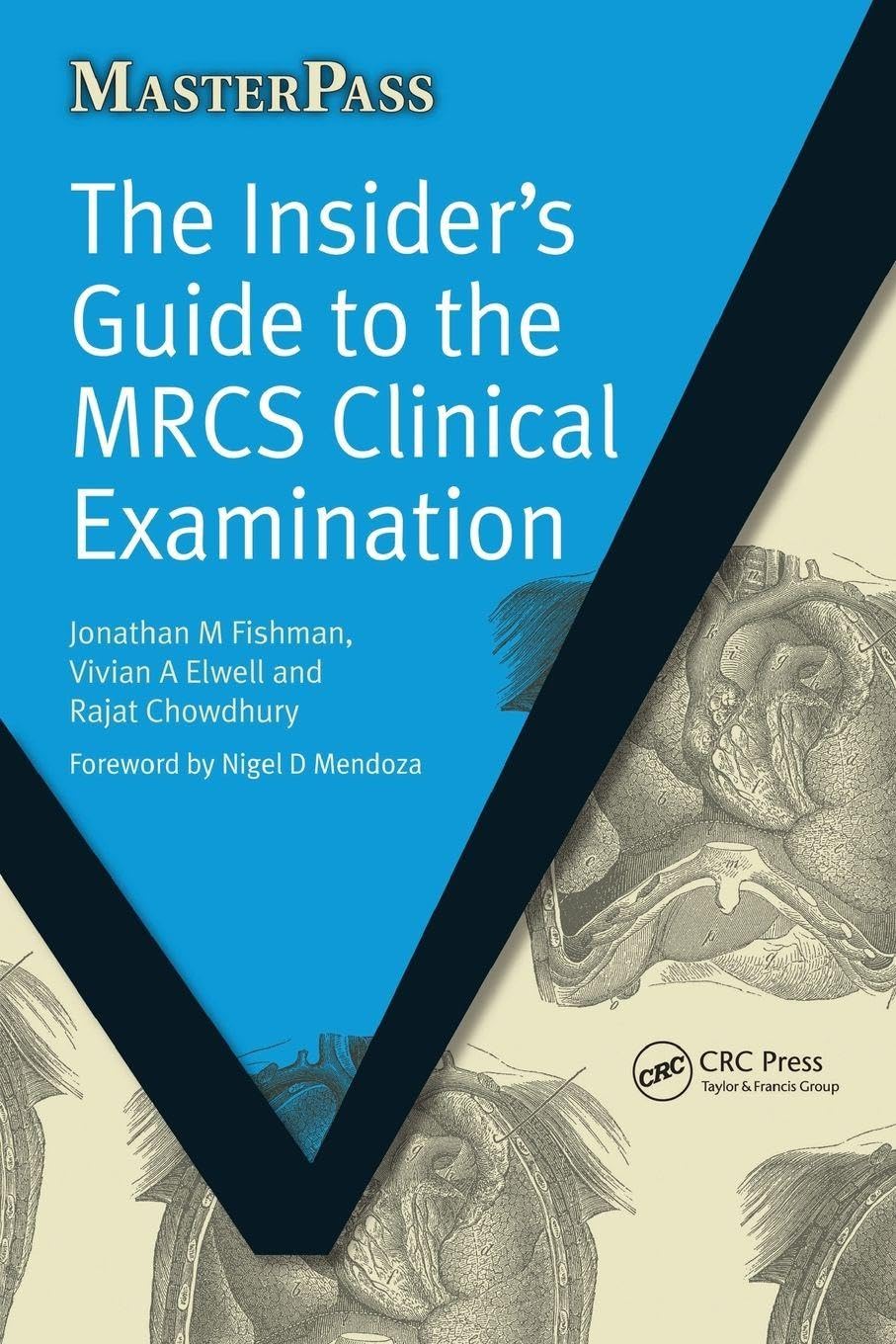 The Insider's Guide to the MRCS Clinical Examination: 1 (Masterp