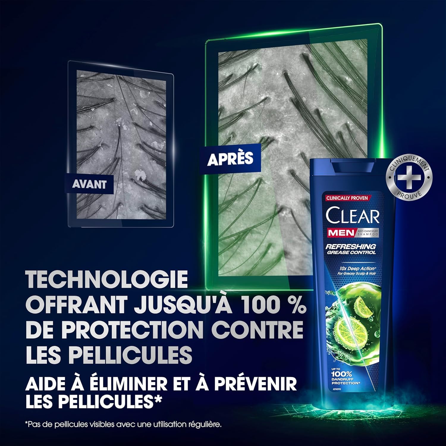 Clear Men Shampooing Antipelliculaire pour cheveux gras Anti-Grease jusqu'à 100% de protection contre les pellicules* 6x 225 ml