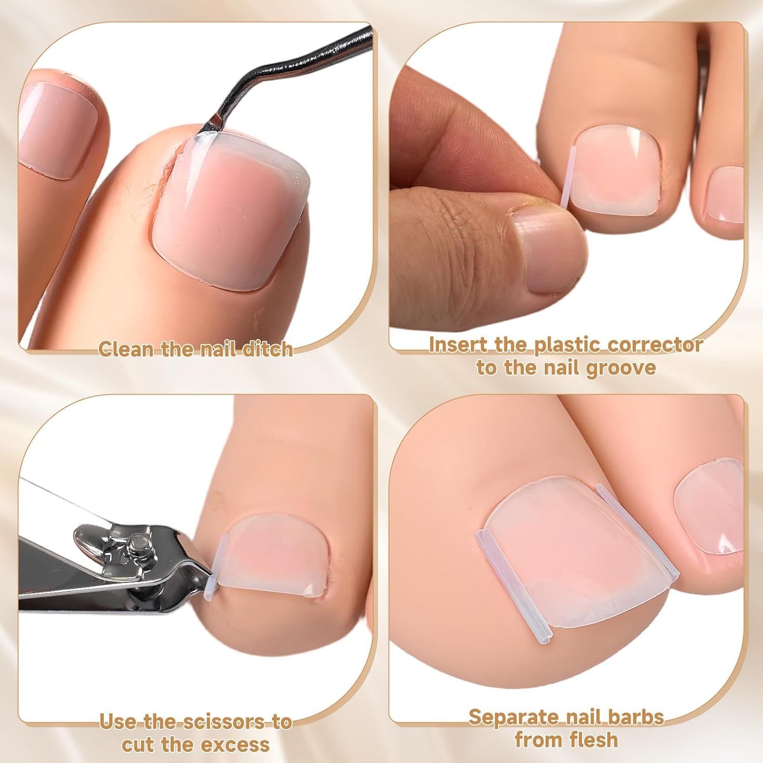 201 Pcs Ingrown Toenail Corrector Kit with Breathable Correction Strips, Curved Nail Patches, Toenail Lifter Tools, Complete Home Pedicure Set for Daily Nail Grooming & Nail Shaping