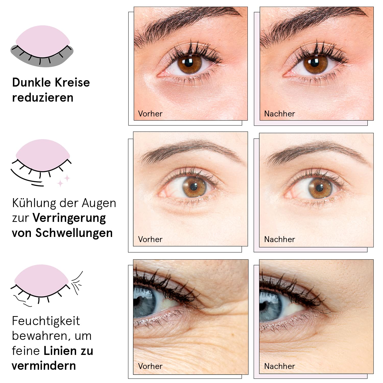 grace & stella - Preisgekrönte Augenpads, Eye Pads Reduzieren Dunkle Augenringe, Gegen Tränensäcke und Falten, Kühlende und Erfrischende Augen Pads Masken, Gel-Eyepads [24 Paare, Gold]