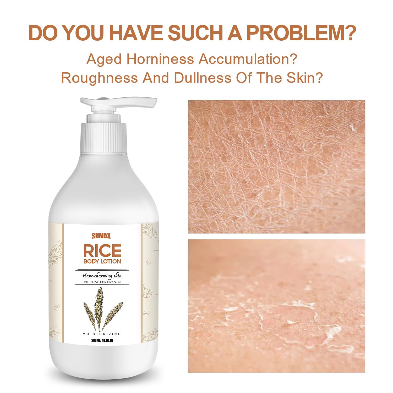 Amazon.com : SURORAIN Rice Moisturizing Skin Lotion 10.1oz- Rice