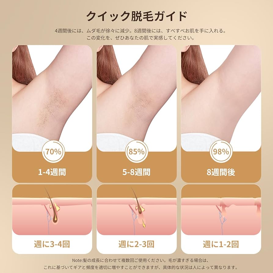 家庭用脱毛器 メンズ レディース【IPL 3.0革新的な赤色波長テクノ Amazon | YUNDOO家庭用脱毛器 メンズ レディース【IPL 3.0革新的