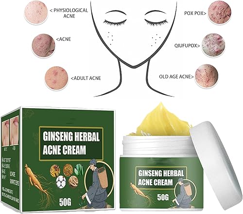 Miniatura 6 de Mnpalettey Crema herbaria del acné del ginseng, crema eliminadora del acné de hierbas, crema de acné a base de hierbas lejos de las marcas del acné