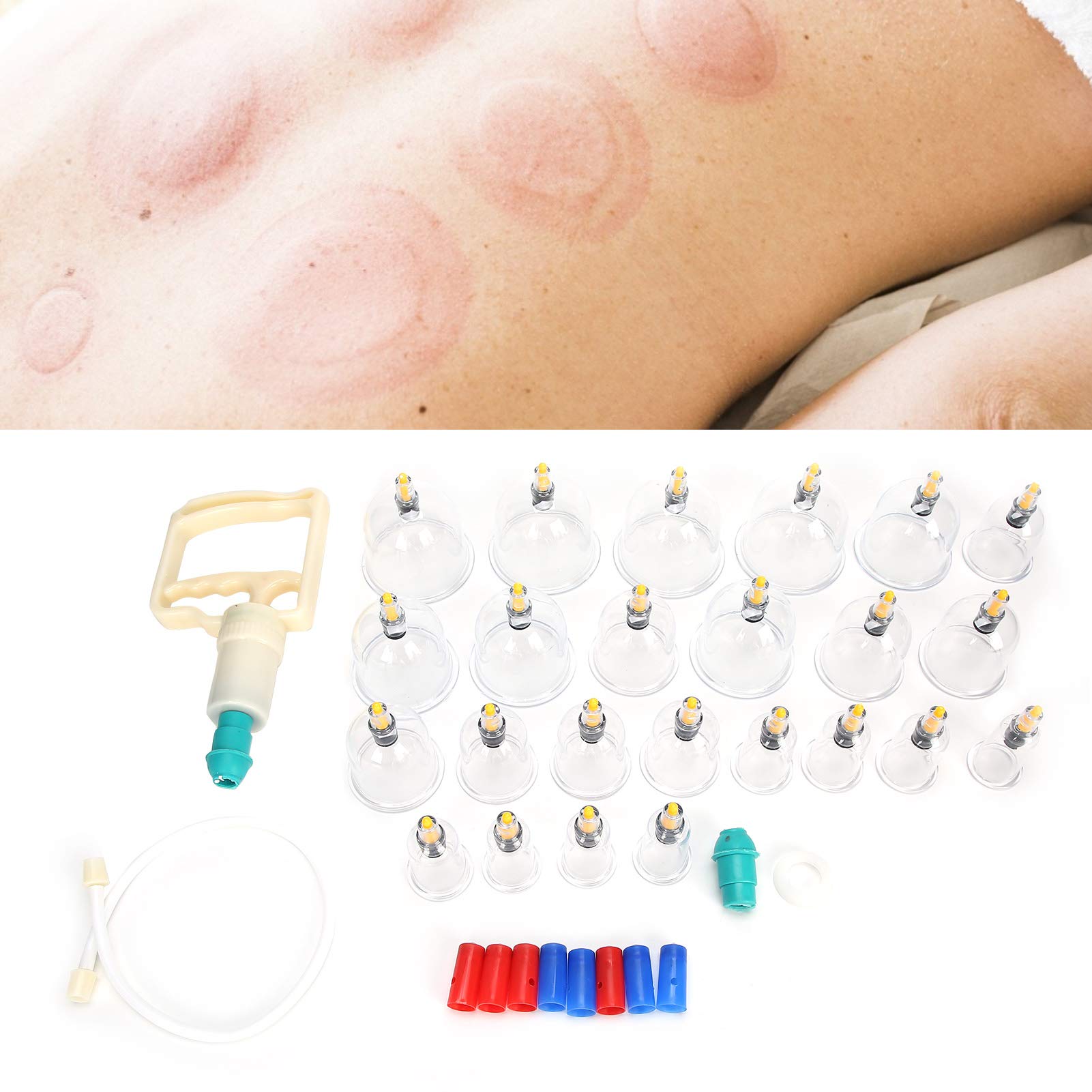 Set per terapia con coppettazione, set professionale per terapia magnetica, set per coppettazione con aspirazione sottovuoto, dispositivo per coppettazione per trattamento del corpo da 24 pezzi