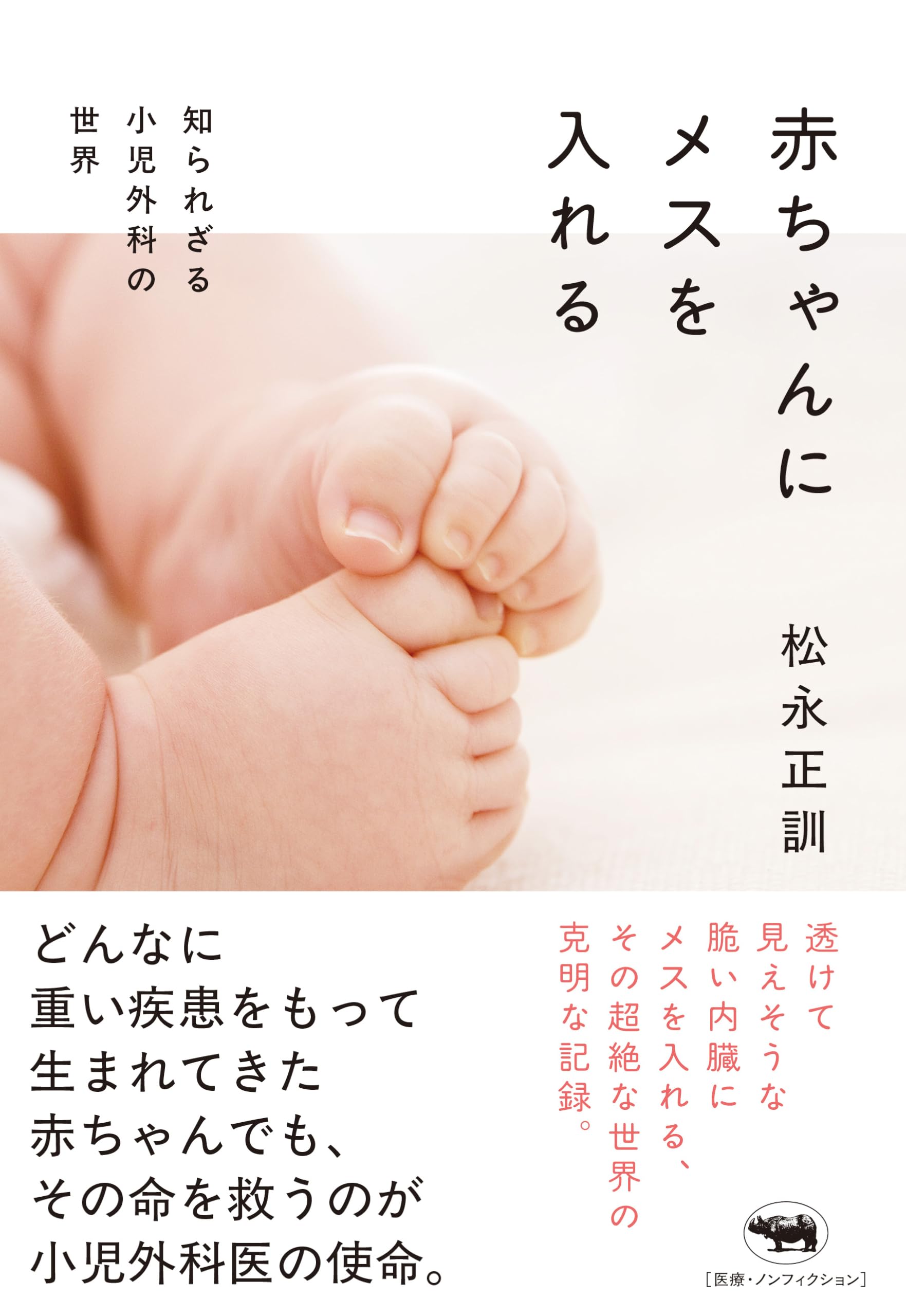 Amazon.co.jp: 赤ちゃんにメスを入れる 知られざる小児外科の世界