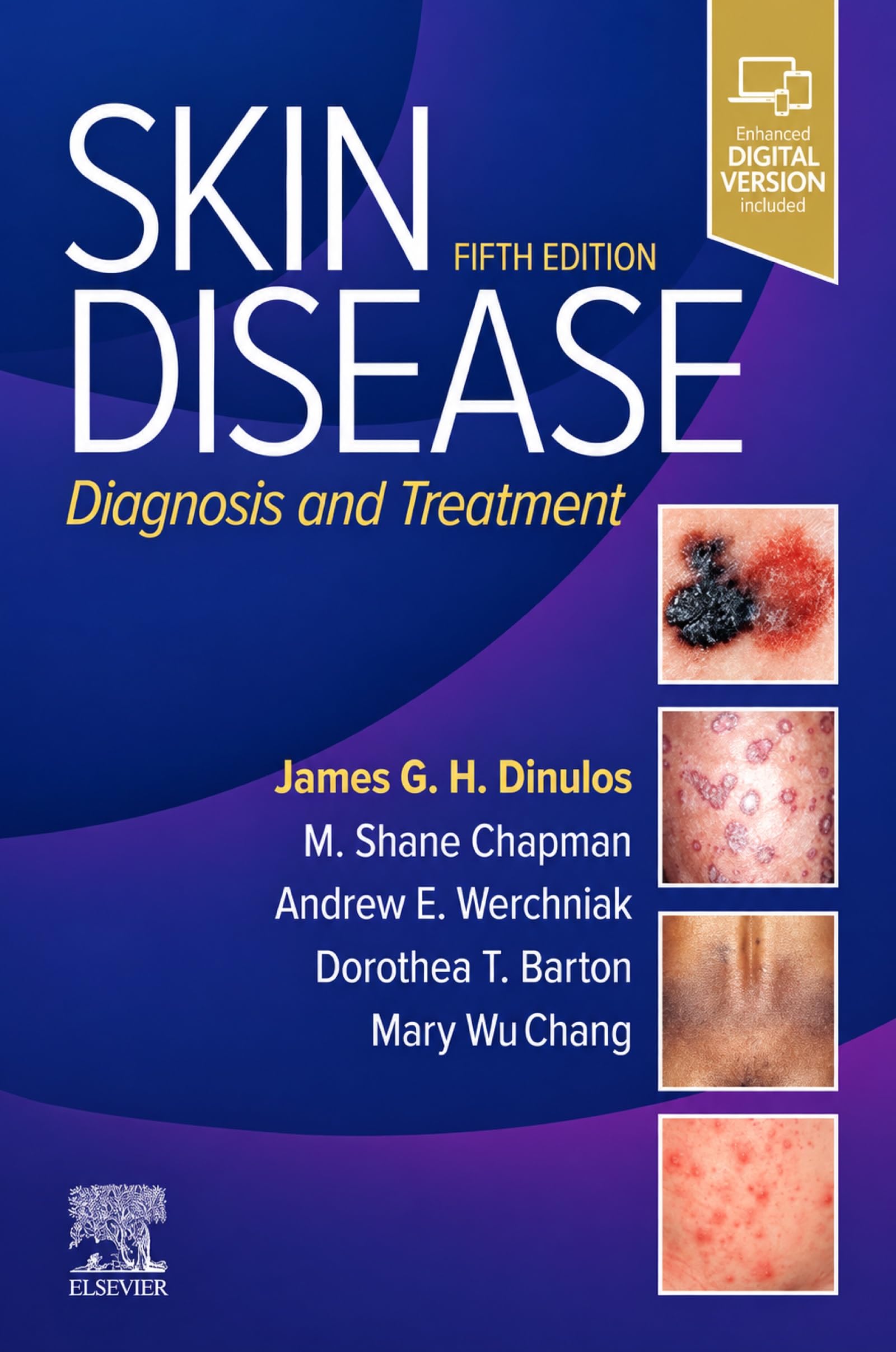 Skin Disease: Diagnosis and Treatment