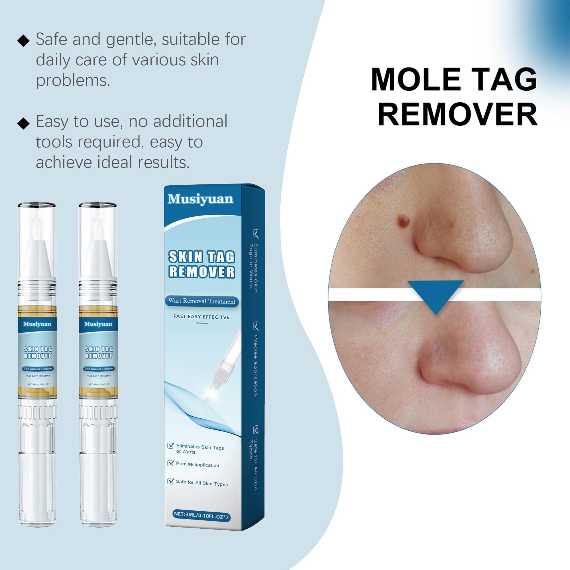Lápiz removedor de verrugas, kit para eliminar verrugas en cuerpo y manos, apto para todo tipo de piel - Paquete de 2