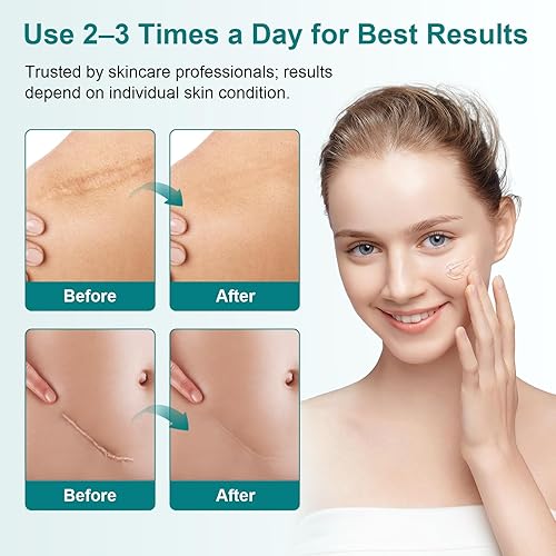 Miniatura 4 de Gel de silicona para cicatrices, potente crema para eliminar cicatrices viejas y nuevas, ayuda a reducir cicatrices quirúrgicas, acné, quemaduras,