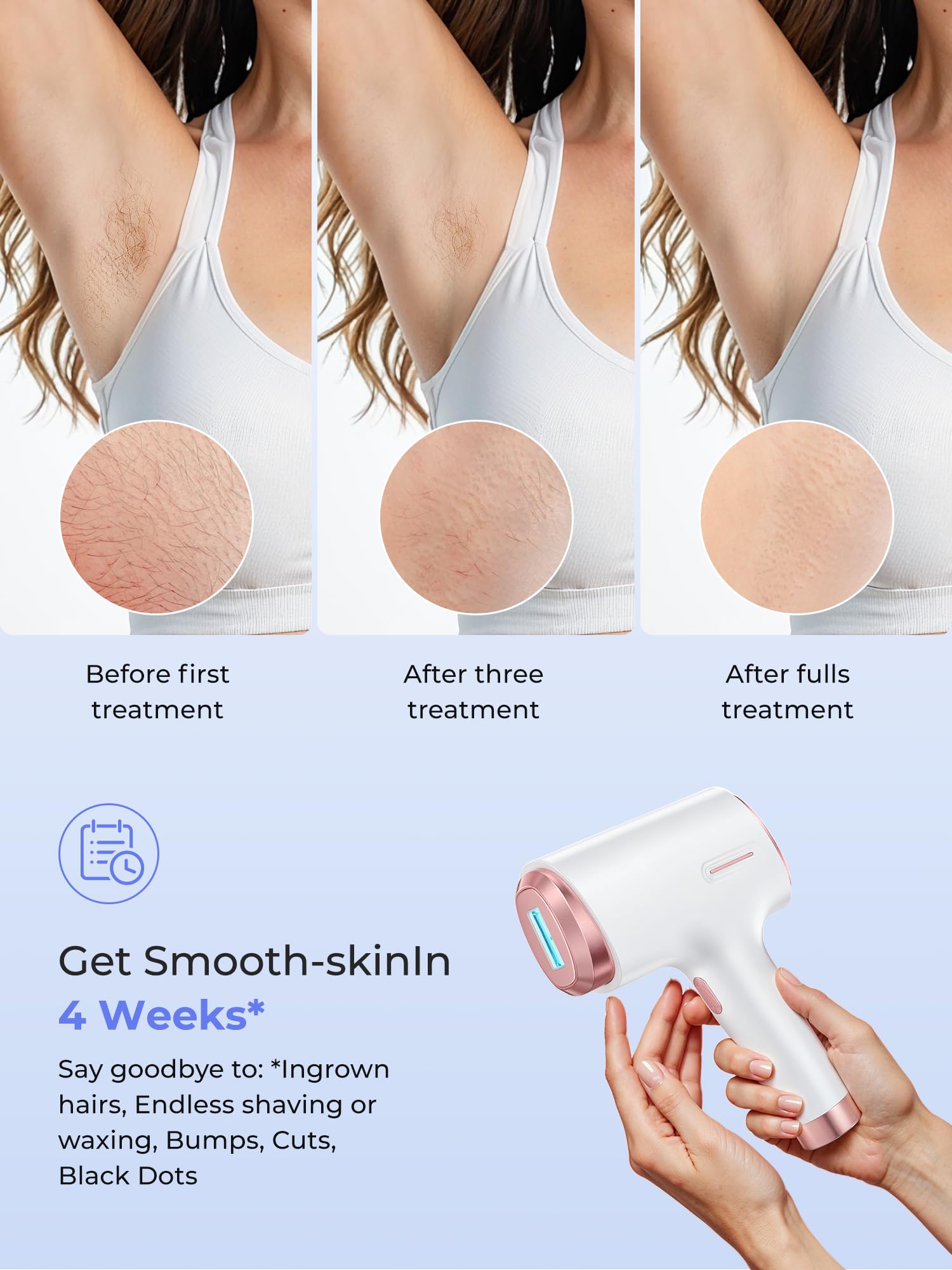 Depilación láser para mujeres y hombres, contacto de enfriamiento de hielo de 45 °F, alternativa segura y prácticamente indolora al dispositivo de depilación IPL de salón, depilación de larga 4