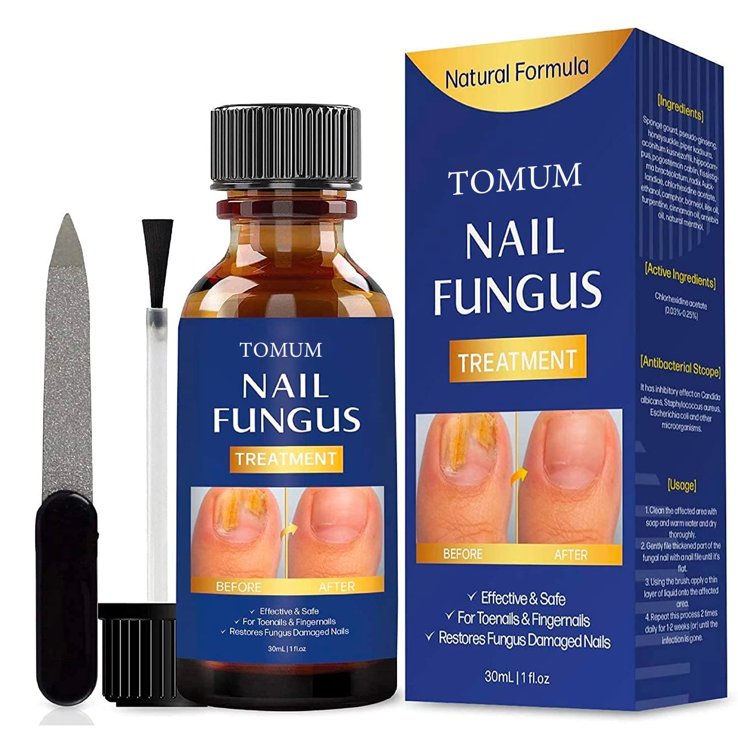 Toenail fungus treatment, Nail Fungus Treatment for