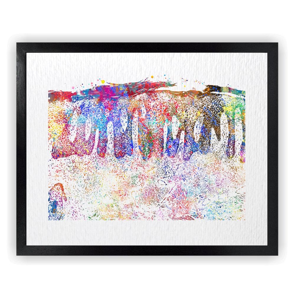 Dignovel Studios 11X14 Unframed Psoriasis Skin Epidermis Histology Dermatology Cell Clinic Medical Watercolor Art Print Poster Wall Hanging DN991
