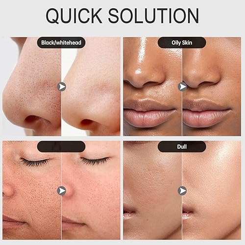 Miniatura 6 de DUBUSH Sebum Mascarilla Exfoliante Carbón de Bambú Máscara Negra Máscara Purificadora de Carbón Máscara Exfoliante de Puntos Negros Máscara de