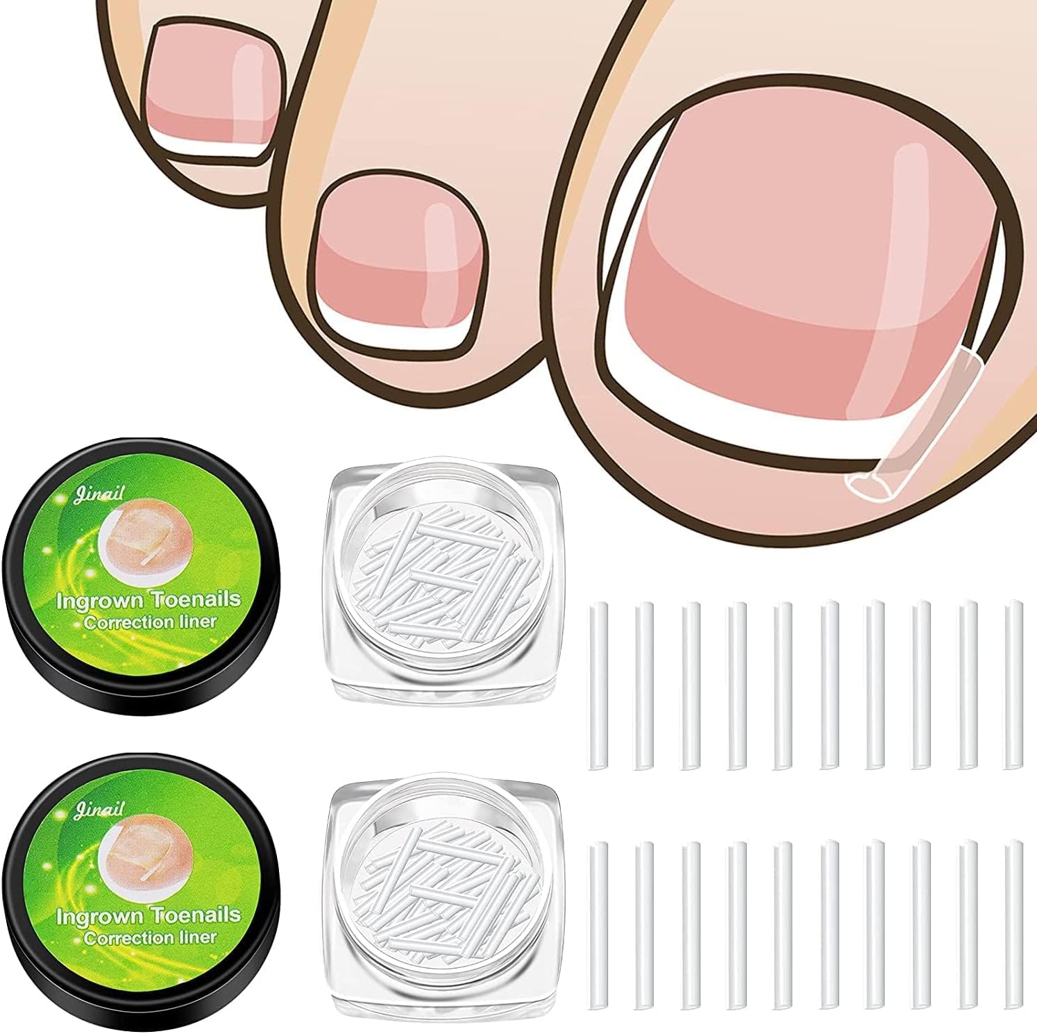 Khazna Toenail Correction Patches Curved Toenails Straightening Recover Clips Thick Paronychia Pedicure Tool Toenail Straightener Strip for Men Women Foot Care 100 Pieces