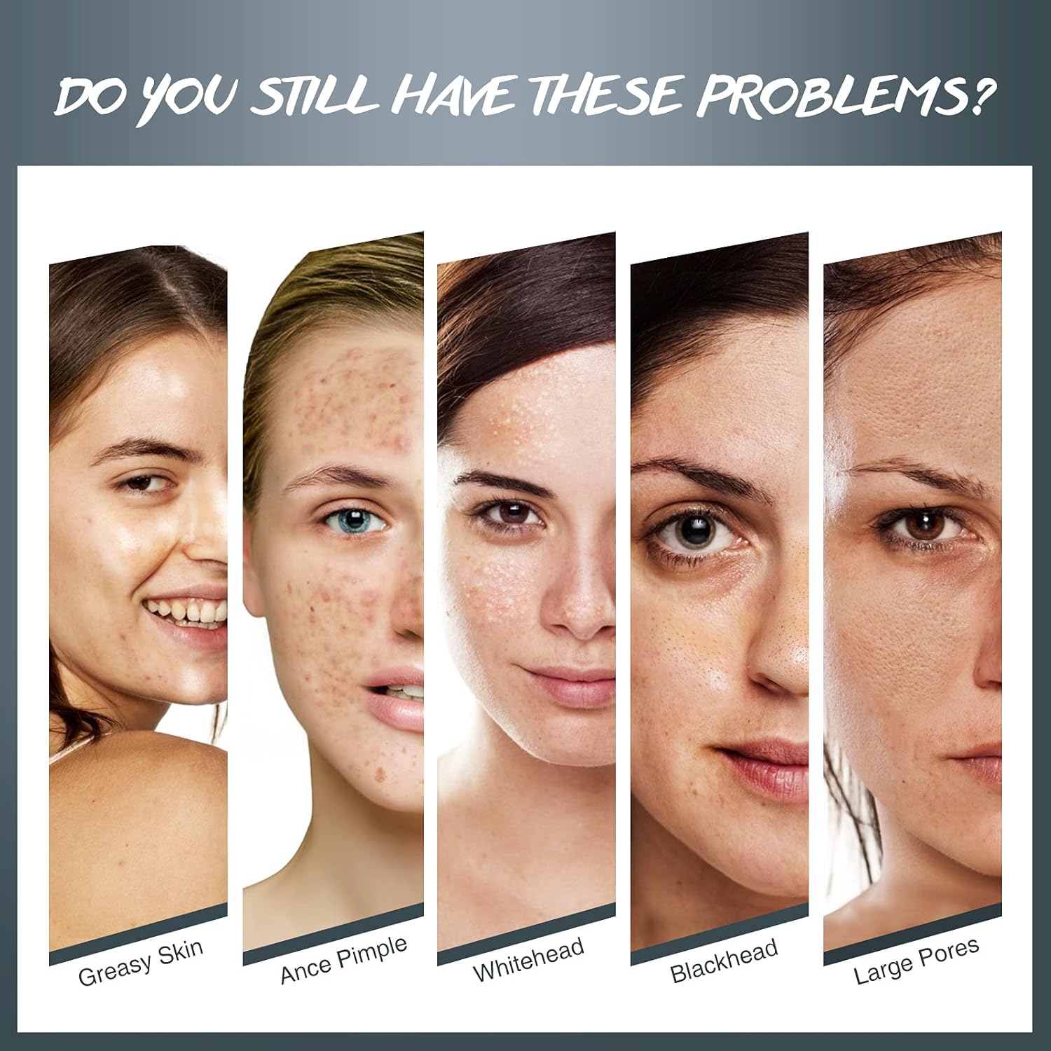 Blackhead Remover Mask with Tea Tree Cream Charcoal Peel Off Facial Mask Blackheads Whiteheads Removal Deep Cleansing Pore Purifying Acne Face Mask with Brush Pimple Extractor 4-in-1 Kit : Beauty & Personal Care