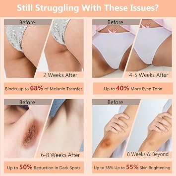 Skin Bleaching Cream for Body-Dark Spots Remover Lightening Cream & Uneven Tone Nourishing Formula Bleaching Intimate Areas & Underarms Inner Thigh, Bikini Line, Armpit Knees Elbows for All Skin Types