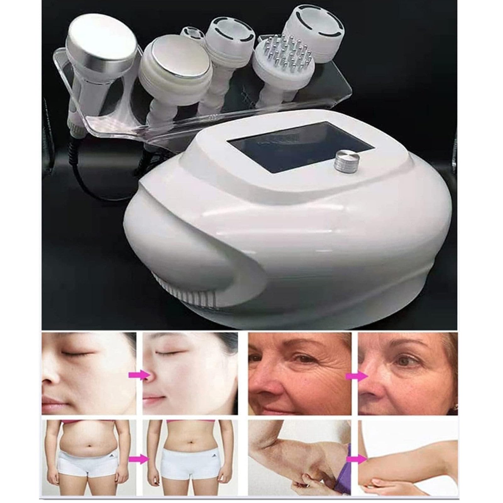 Máquina De Liposucción Liposucción Cavitación Celulitis Slimming 80k Grasa Quema RF Radiofrecuencia Máquina para Salones De Belleza, Salones De Masajes, Tiendas De Raspado
