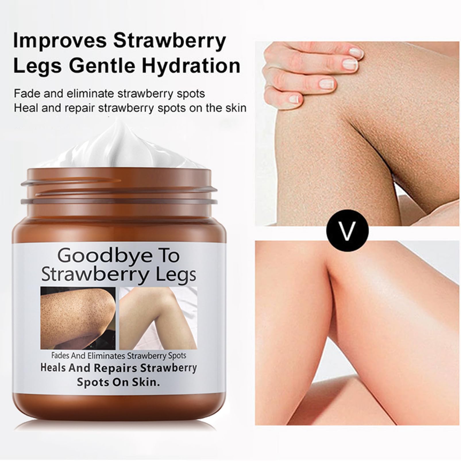 Strawberry Legs Treatment,Keratosis Pilaris Cream,Strawberry Skin Treatment,Skin Exfoliating Repair Cream,Moisturizing Body Cream,Rough Bumpy Skin Body Lotion(120g) - Image 2