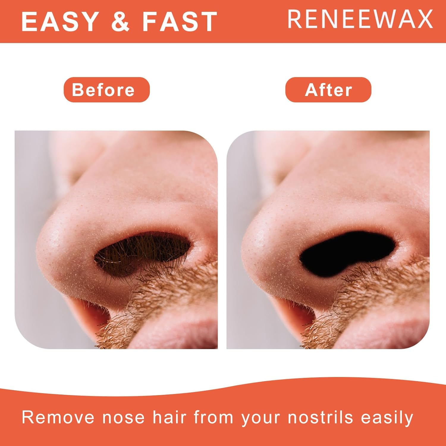 RENEEWAX Nose Wax Kit, 3.5 oz Nose Hair Wax, Nose Hair Removal Wax Kit with 20 wax sticks, Nose Ear Hair Waxing Kit