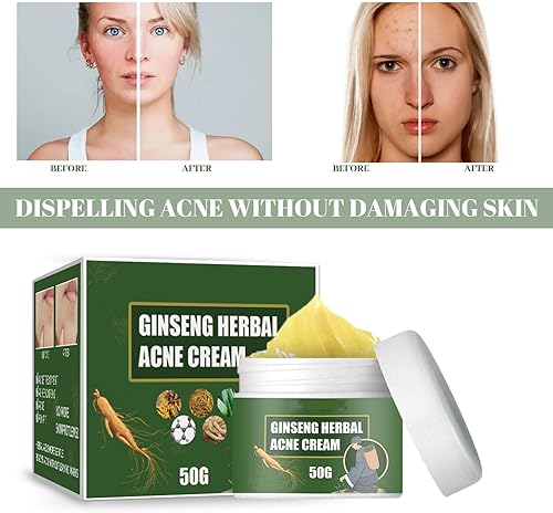 Miniatura 3 de Mnpalettey Crema herbaria del acné del ginseng, crema eliminadora del acné de hierbas, crema de acné a base de hierbas lejos de las marcas del acné