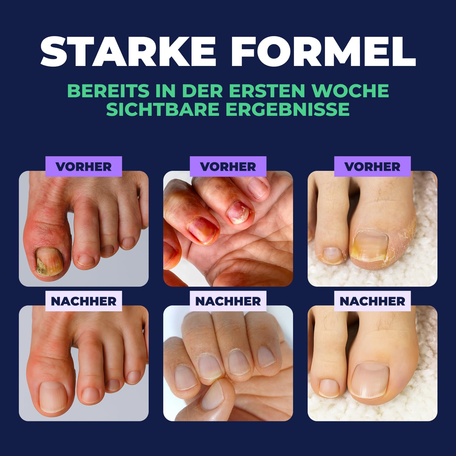 Orivelle Nagelpflegestift – Kosmetische Pflege für Nägel & Nagelhaut | Gepflegtes, optisches Erscheinungsbild | Nagelpflegestift für den täglichen Gebrauch (2er-Pack)