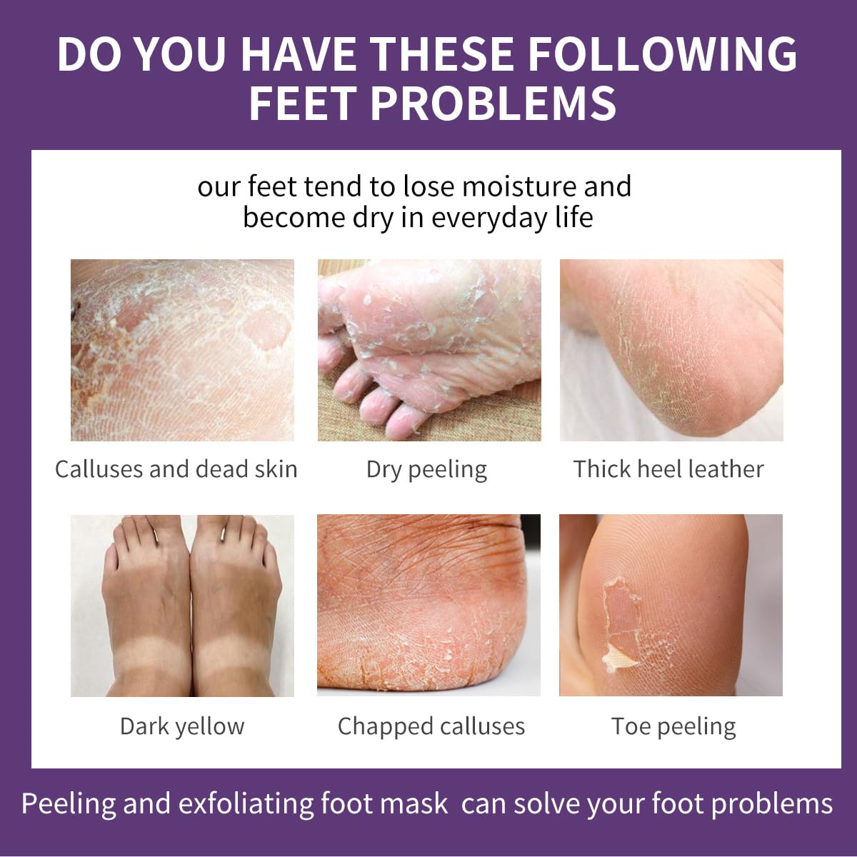 Foot Peel Mask & Exfoliating Socks - Hydrates Dry Cracked Feet, Removes Dead Skin and Calluses for Men and Women - Professional Foot Care​ (12PCS)