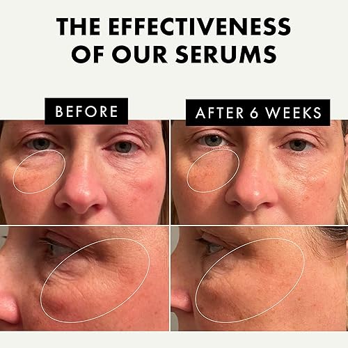 Miniatura 5 de Eclat Skincare Unlock Your Glow - Set de crema hidratante facial y sueros faciales con vitamina C, 100% vegano y desarrollado por dermatólogos